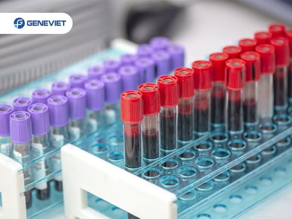 Có thể tự lấy mẫu xét nghiệm ADN huyết thống tại nhà được không?