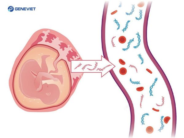 Xét nghiệm ADN thai nhi không xâm lấn có chính xác không?