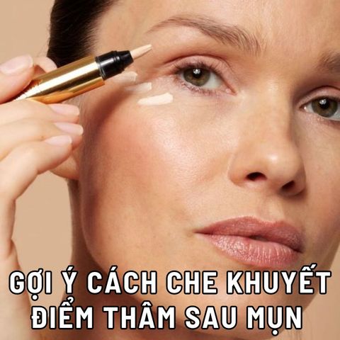 GỢI Ý CÁCH CHE KHUYẾT ĐIỂM THÂM SAU MỤN CỰC ĐƠN GIẢN