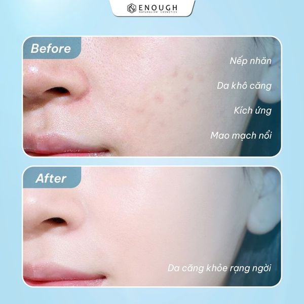 kem dưỡng ẩm 3x enough công dụng