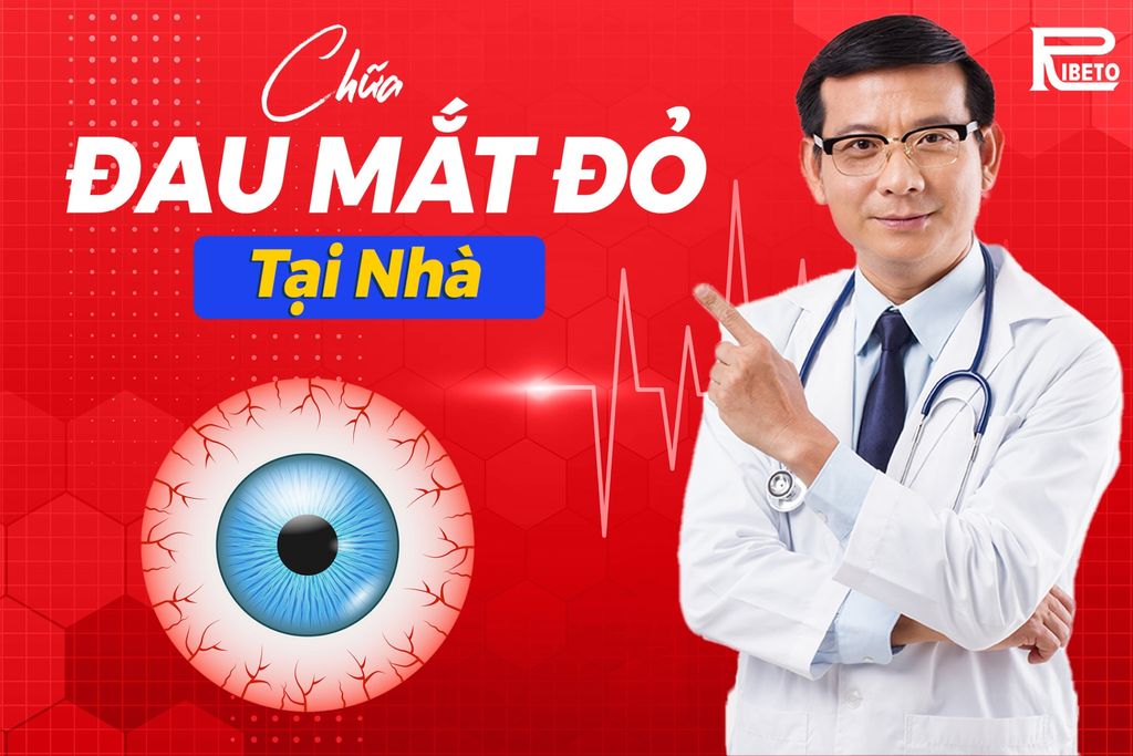 Cách Chữa Đau Mắt Đỏ Tại Nhà