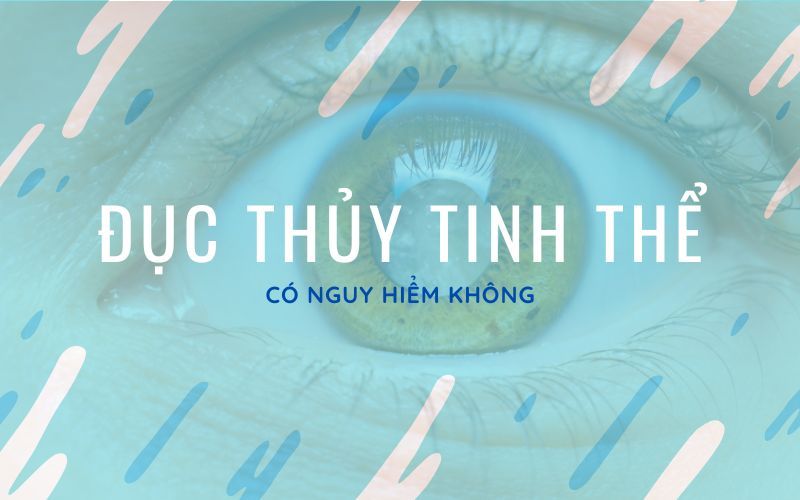 Đục thủy tinh thể có nguy hiểm không? Đừng chủ quan