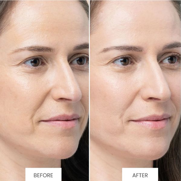 HIỆU QUẢ MANG LẠI