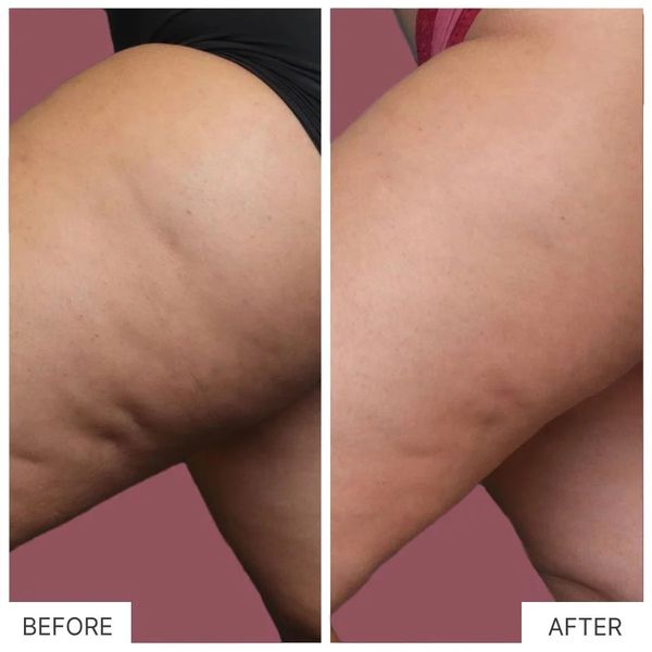 HIỆU QUẢ MANG LẠI