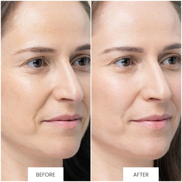 RESULTS LOVED BY YOU