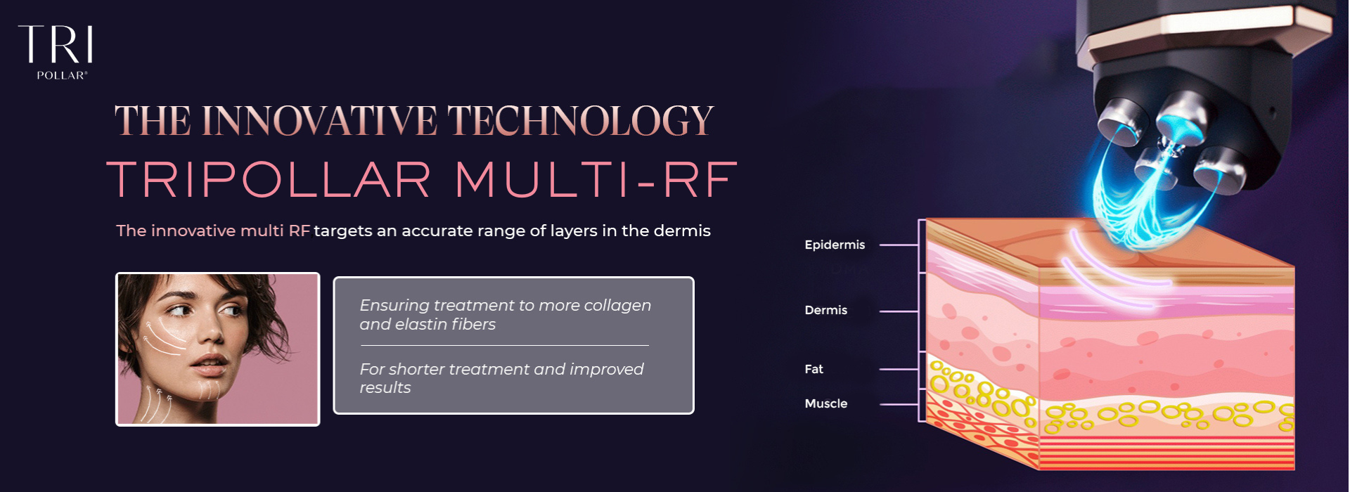 WHAT IS RF?