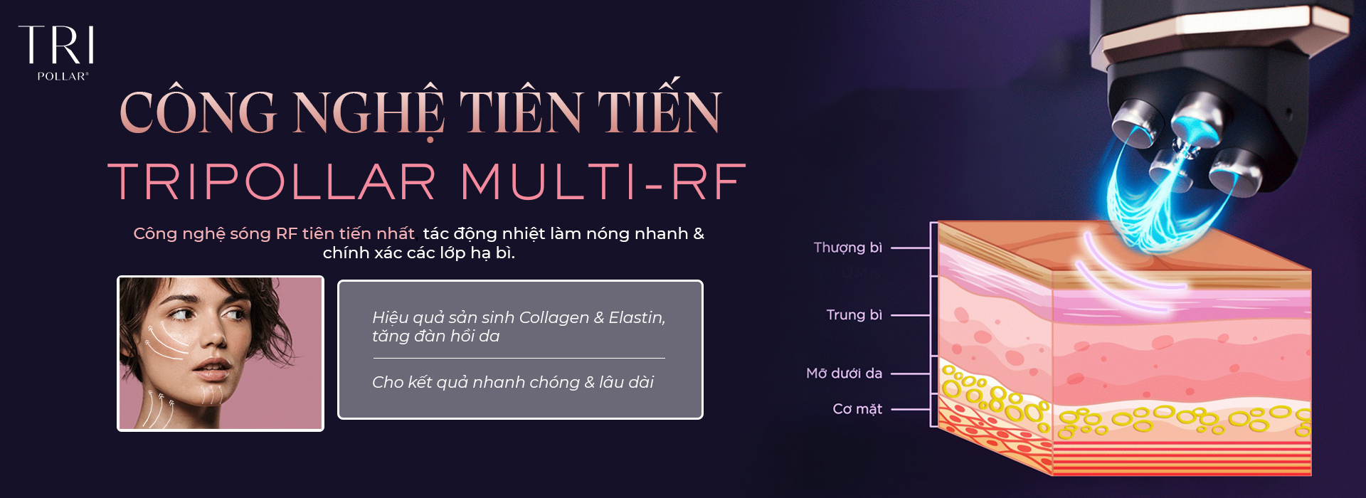 CÔNG NGHỆ SÓNG RF LÀ GÌ?
