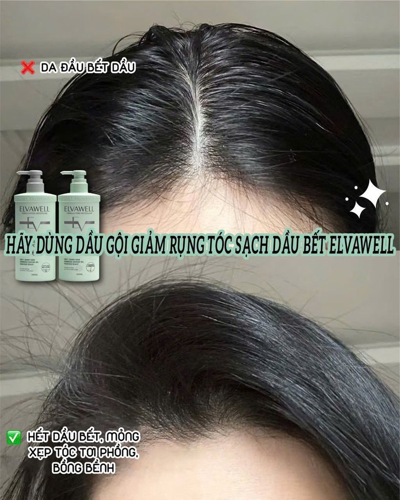 review-dau-goi-elvawell-sach-dau-bet