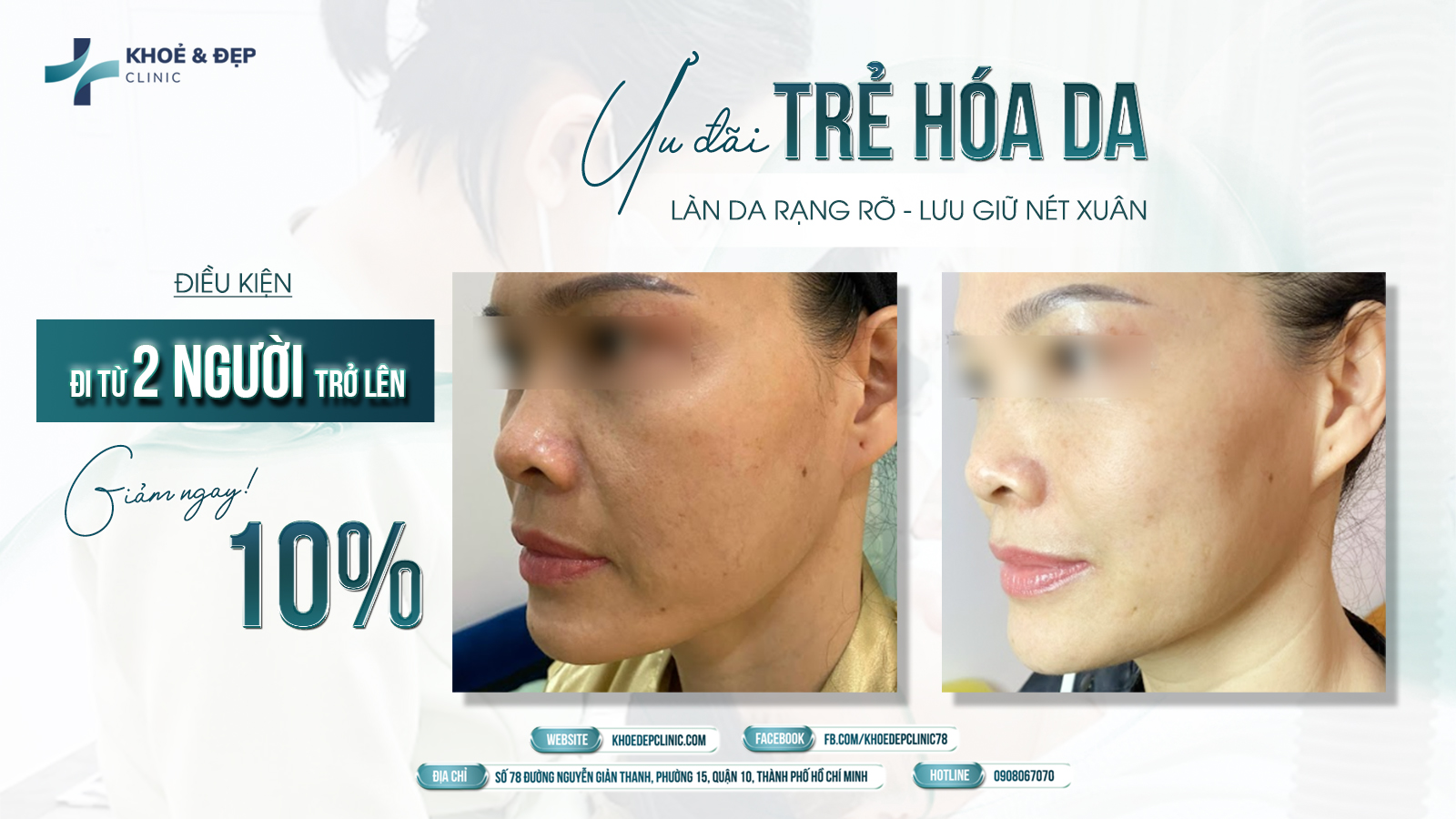 👭 “Rủ bạn thân đi làm đẹp – vừa vui, vừa lợi!”