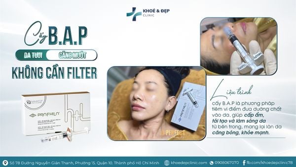 CẤY B.A.P - DA TƯƠI, CĂNG MƯỚT KHÔNG CẦN FILTER