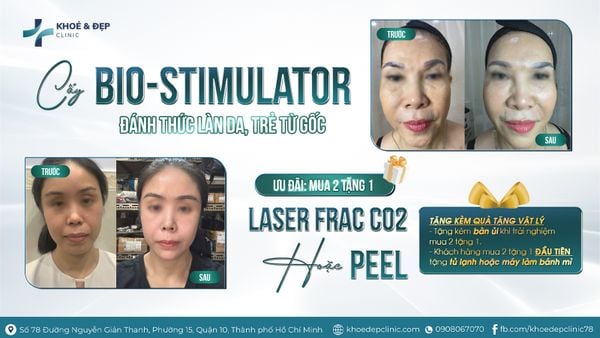 💉 CẤY BIO-STIMULATOR – ĐÁNH THỨC LÀN DA, TRẺ TỪ GỐC!