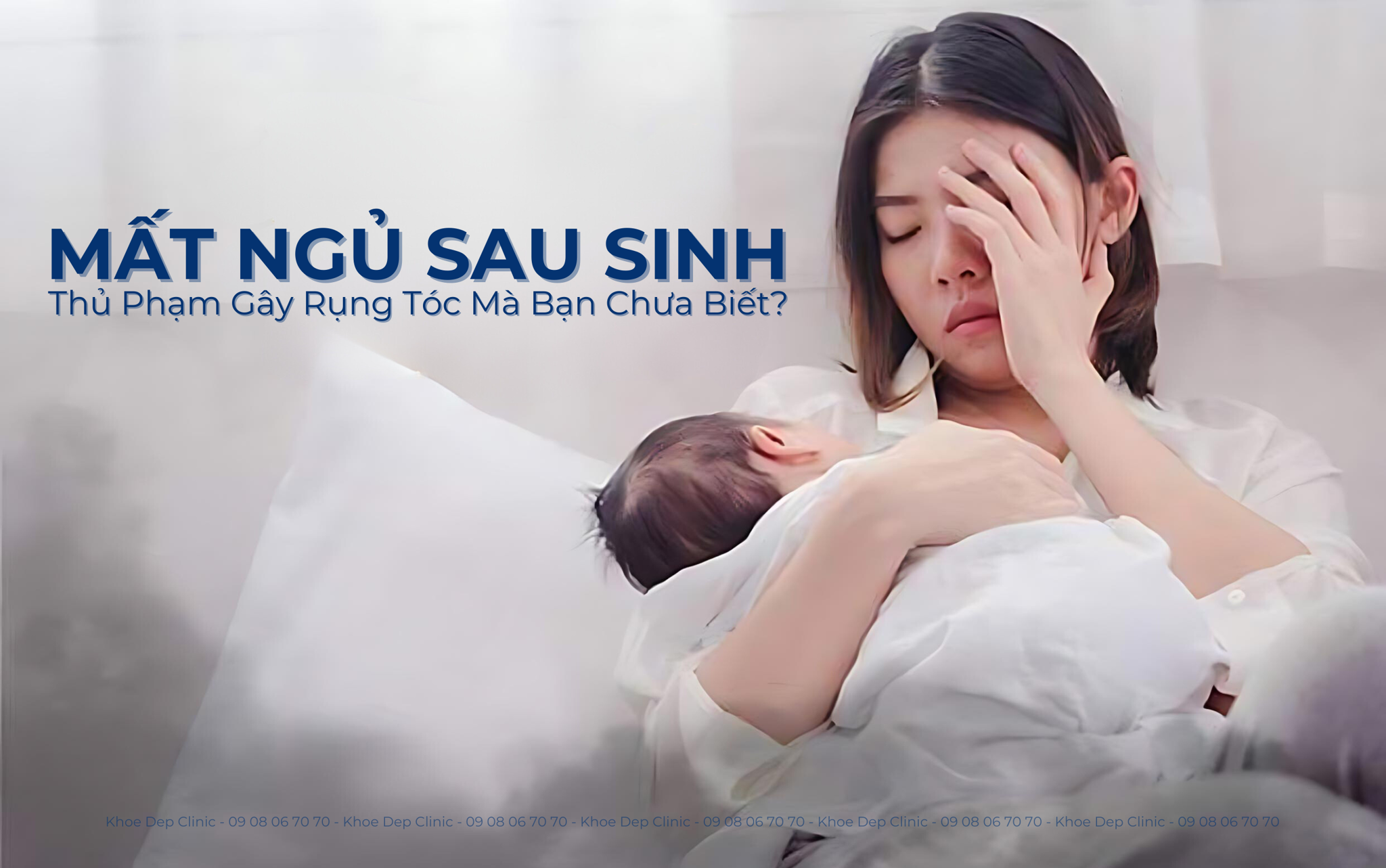 Mất Ngủ Sau Sinh: Thủ Phạm Gây Rụng Tóc Mà Bạn Chưa Biết?