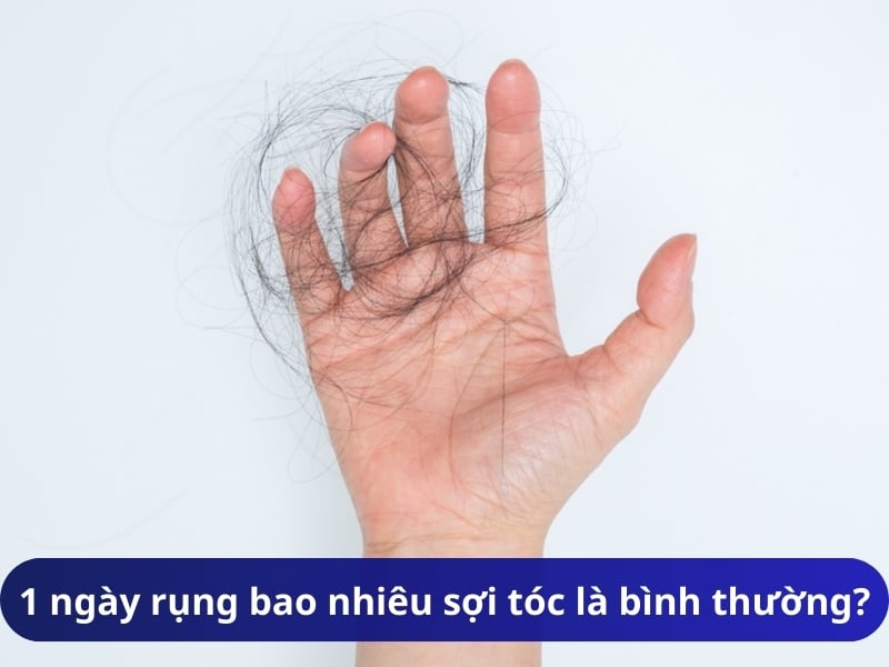 1 ngày rụng bao nhiêu sợi tóc là bình thường?