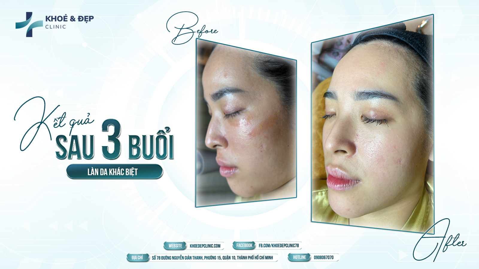 𝐊𝐡𝐨̉𝐞 & Đ𝐞̣𝐩 𝐂𝐥𝐢𝐧𝐢𝐜 – Cùng bạn sống khỏe mỗi ngày