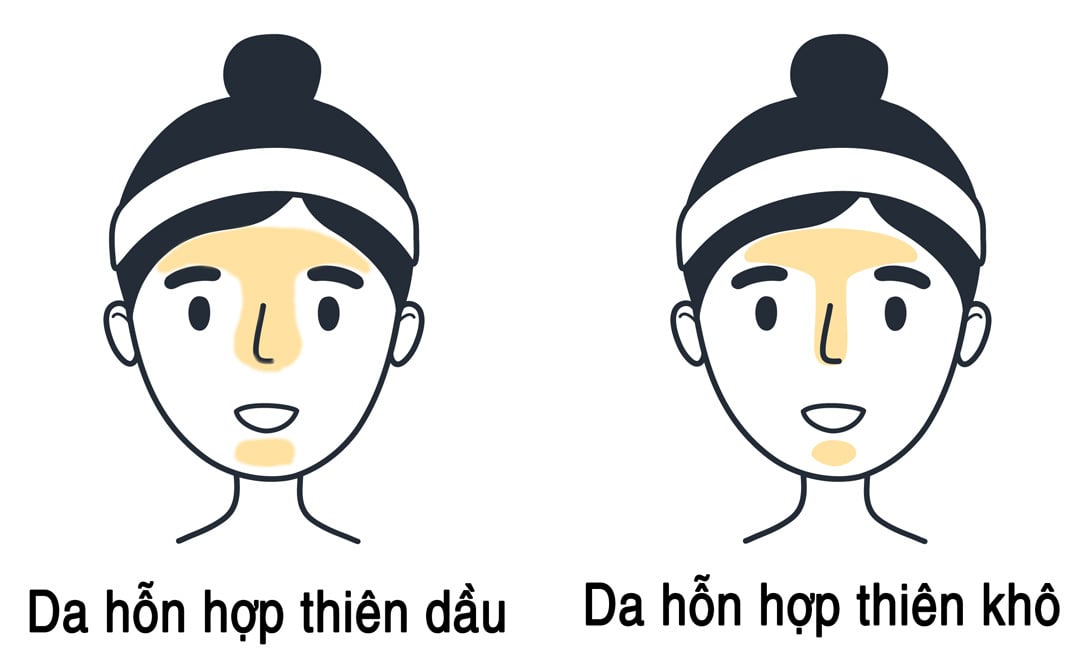 Da hỗn hợp thiên khô là gì? Nguyên nhân và cách chăm sóc hiệu quả