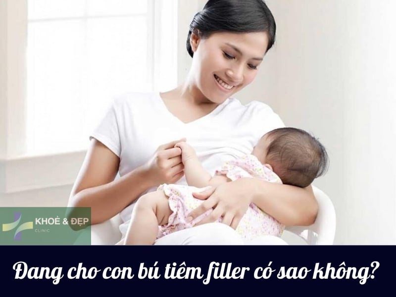 Phụ nữ đang cho con bú tiêm filler được không?