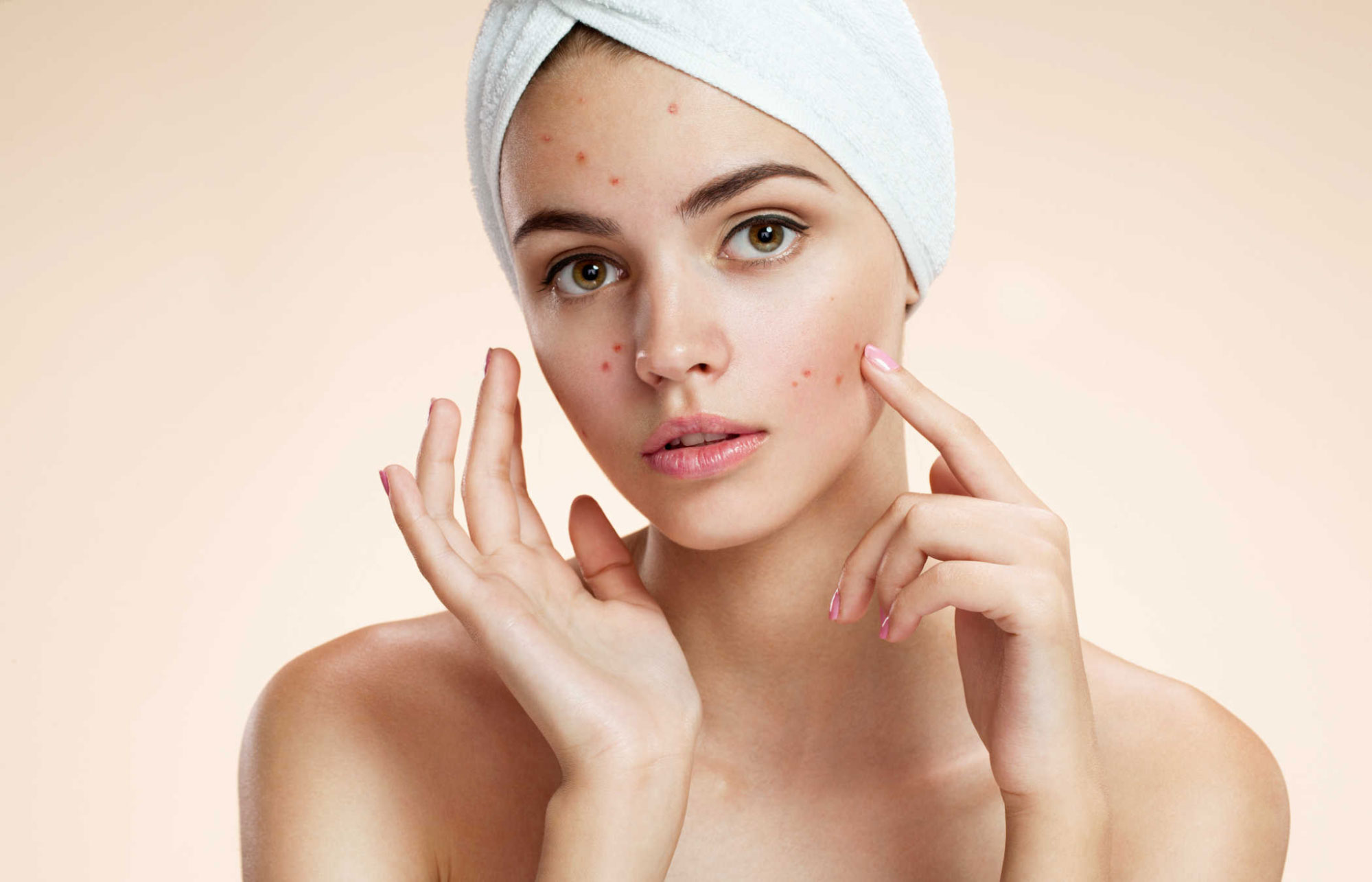 Quy trình chăm sóc và phục hồi làn da hư tổn sau mụn