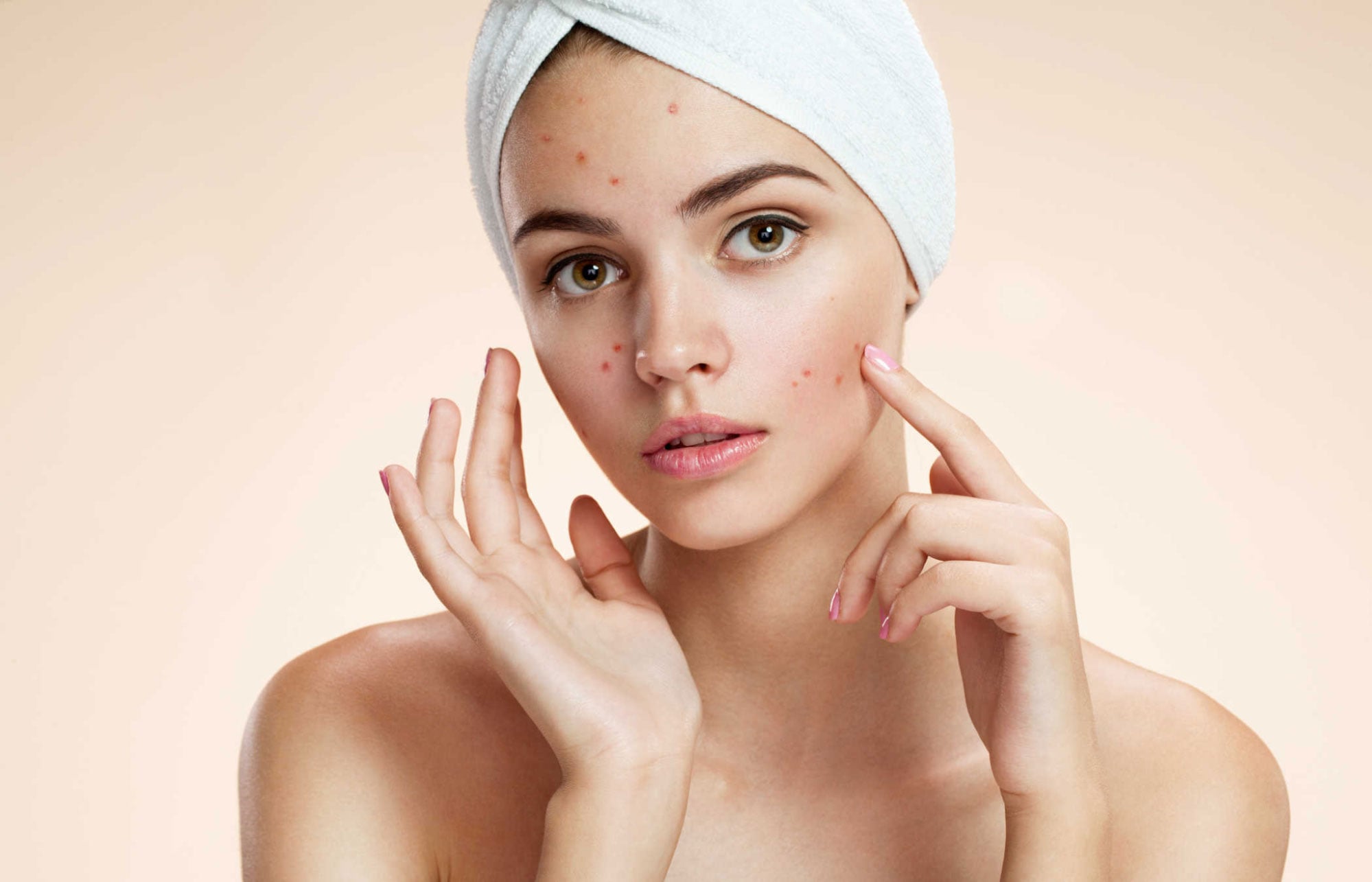 Nguyên nhân gây da dầu mụn và cách khắc phục hiệu quả