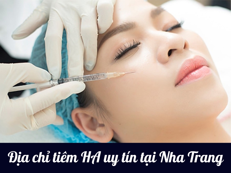 Top 6 địa chỉ tiêm filler tại Nha Trang uy tín