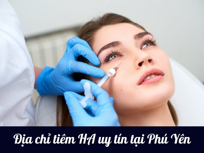 Top 4 địa chỉ tiêm filler tại Phú Yên uy tín