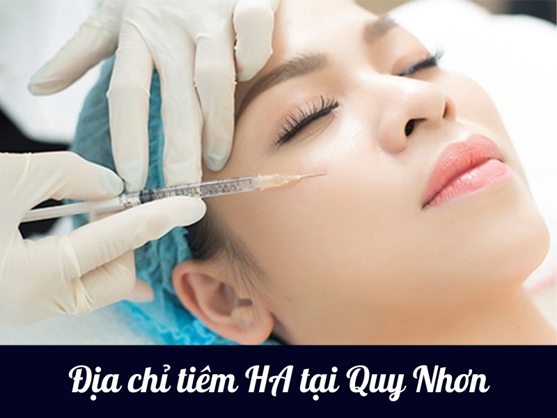 Top 10 địa chỉ tiêm filler tại Quy Nhơn uy tín