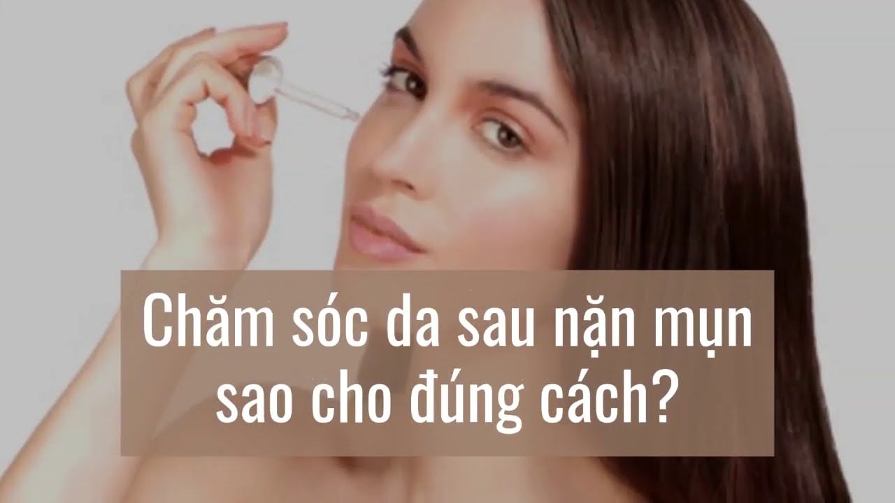 Cách chăm sóc da sau nặn mụn mà bạn cần biết