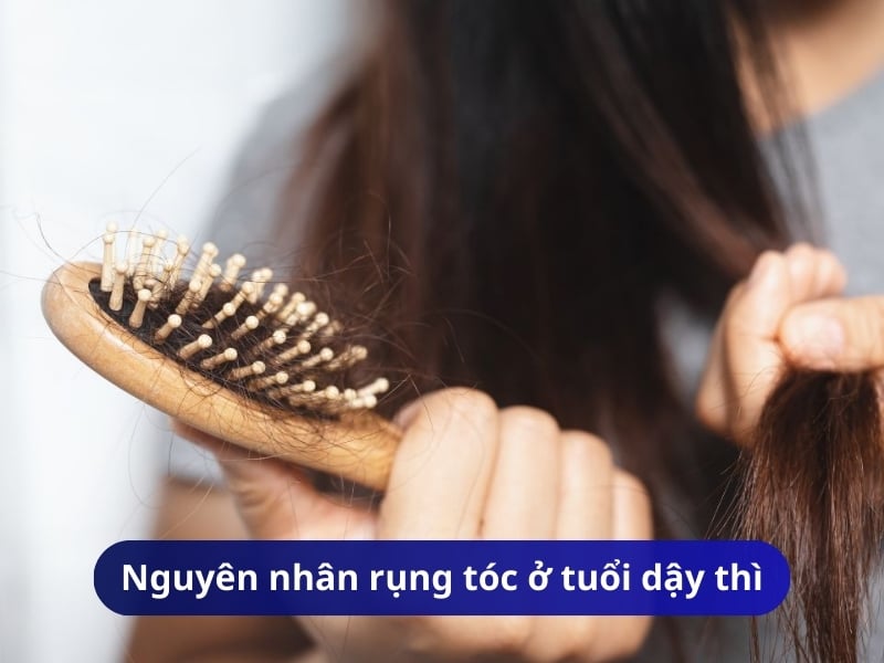 Nguyên nhân rụng tóc ở tuổi dậy thì