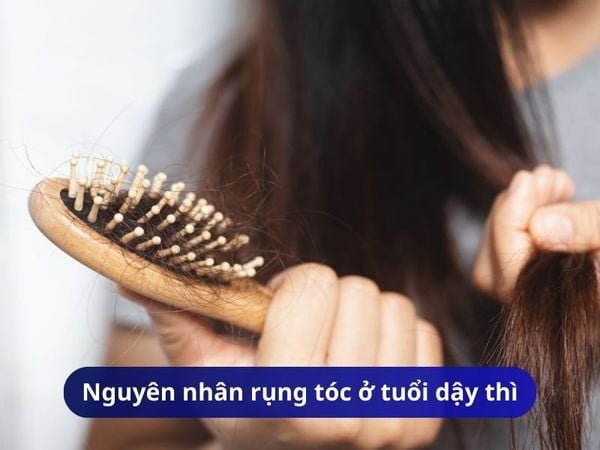 Nguyên nhân rụng tóc ở tuổi dậy thì