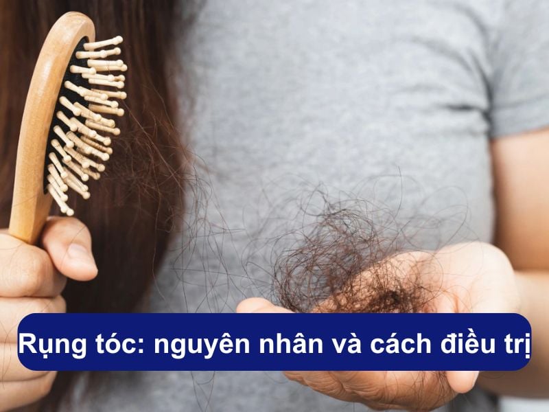 Rụng tóc là gì? Các nguyên nhân rụng tóc và cách điều trị hiệu quả