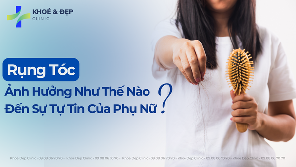 Rụng tóc sau sinh: lấy lại sự tự tin cùng cấy tóc vi mô tự thân (AMT) & Nourkrin
