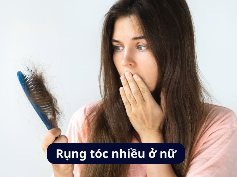 Rụng tóc nhiều ở nữ: nguyên nhân và biện pháp điều trị hiệu quả
