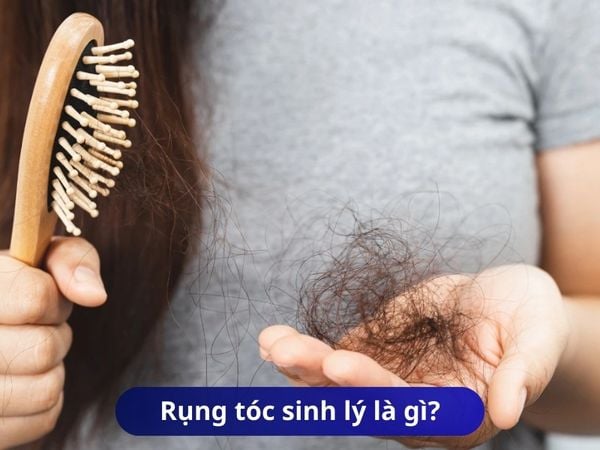 Rụng tóc sinh lý là gì, cách phân biệt rụng tóc sinh lý và rụng tóc bệnh lý