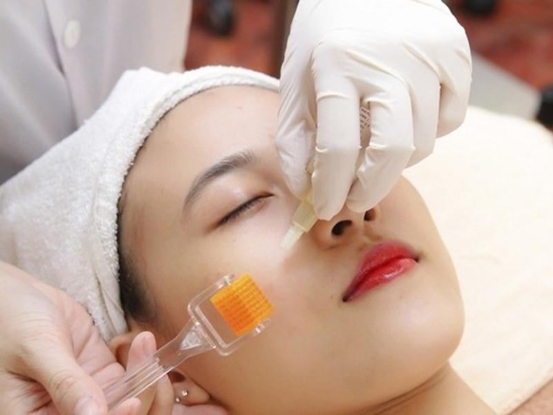 Top 6 địa chỉ tiêm filler tại Vũng Tàu an toàn
