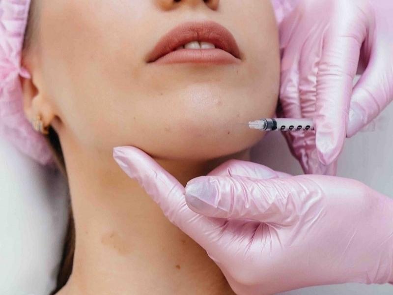 Top 8 địa chỉ tiêm filler tại Huế an toàn và được yêu thích