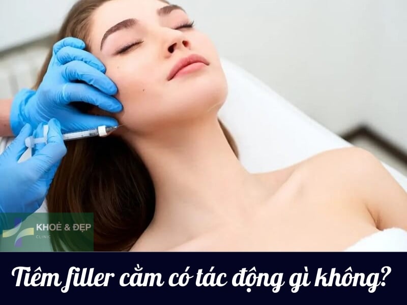 Tiêm filler cằm có ảnh hưởng gì không? Bao lâu thì ổn định?