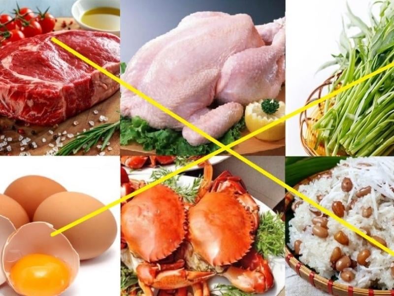 Tiêm filler cần kiêng gì? Cần kiêng trong bao lâu?