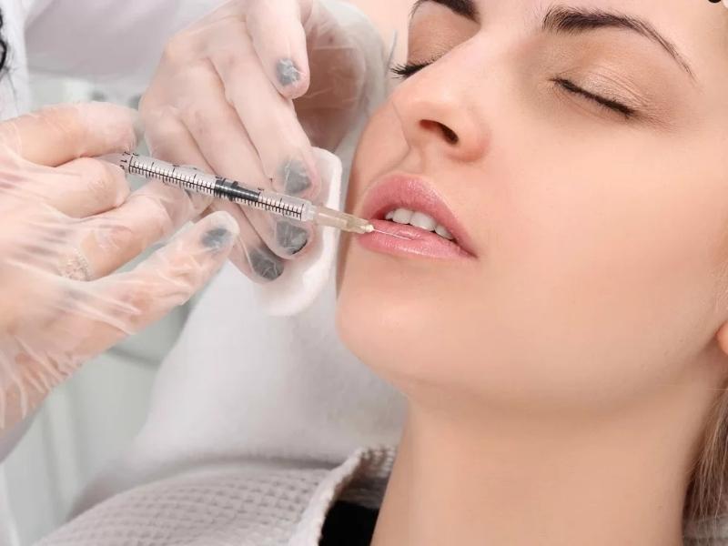 Tiêm filler môi là gì? Những dáng môi đẹp nhất 2024