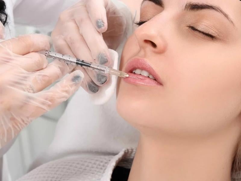 Có tiêm filler môi dày thành mỏng được không?