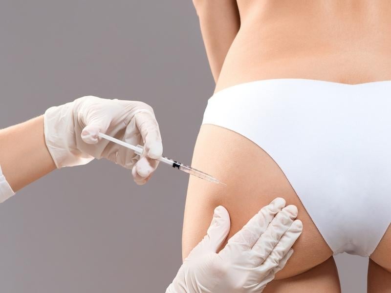 Tiêm filler mông giá bao nhiêu nhiêu? Giữ được bao lâu?