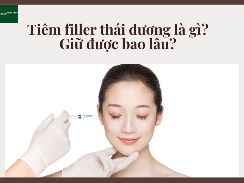 Tiêm filler thái dương là gì? Giữ được bao lâu?
