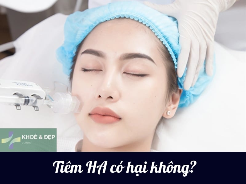 Tiêm HA có hại không? Những vấn đề thường gặp sau tiêm HA