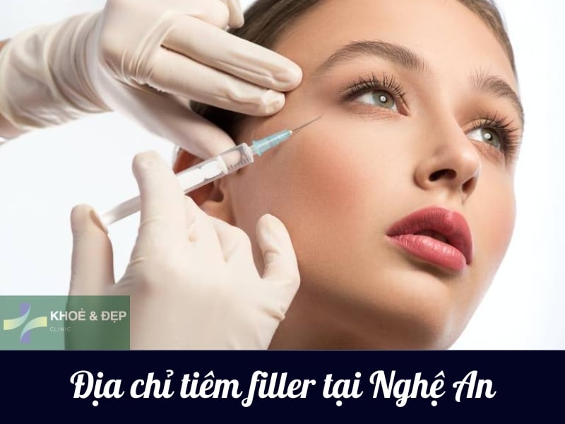 Top 7 địa chỉ tiêm filler tại Nghệ An an toàn, uy tín