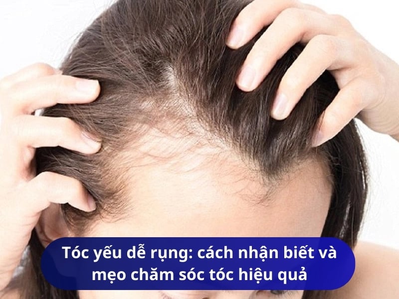 Tóc yếu dễ rụng: cách nhận biết và mẹo chăm sóc tóc yếu hiệu quả