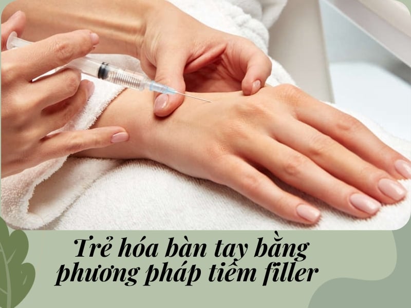 Trẻ hóa bàn tay bằng phương pháp tiêm filler bàn tay