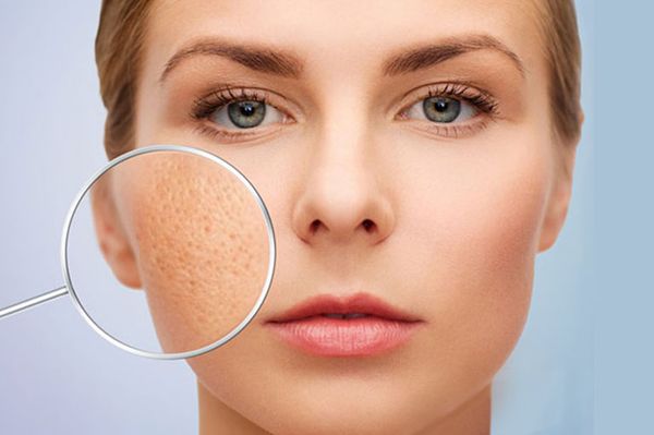 Sẹo đáy nhọn: Nguyên Nhân, Cách Điều Trị