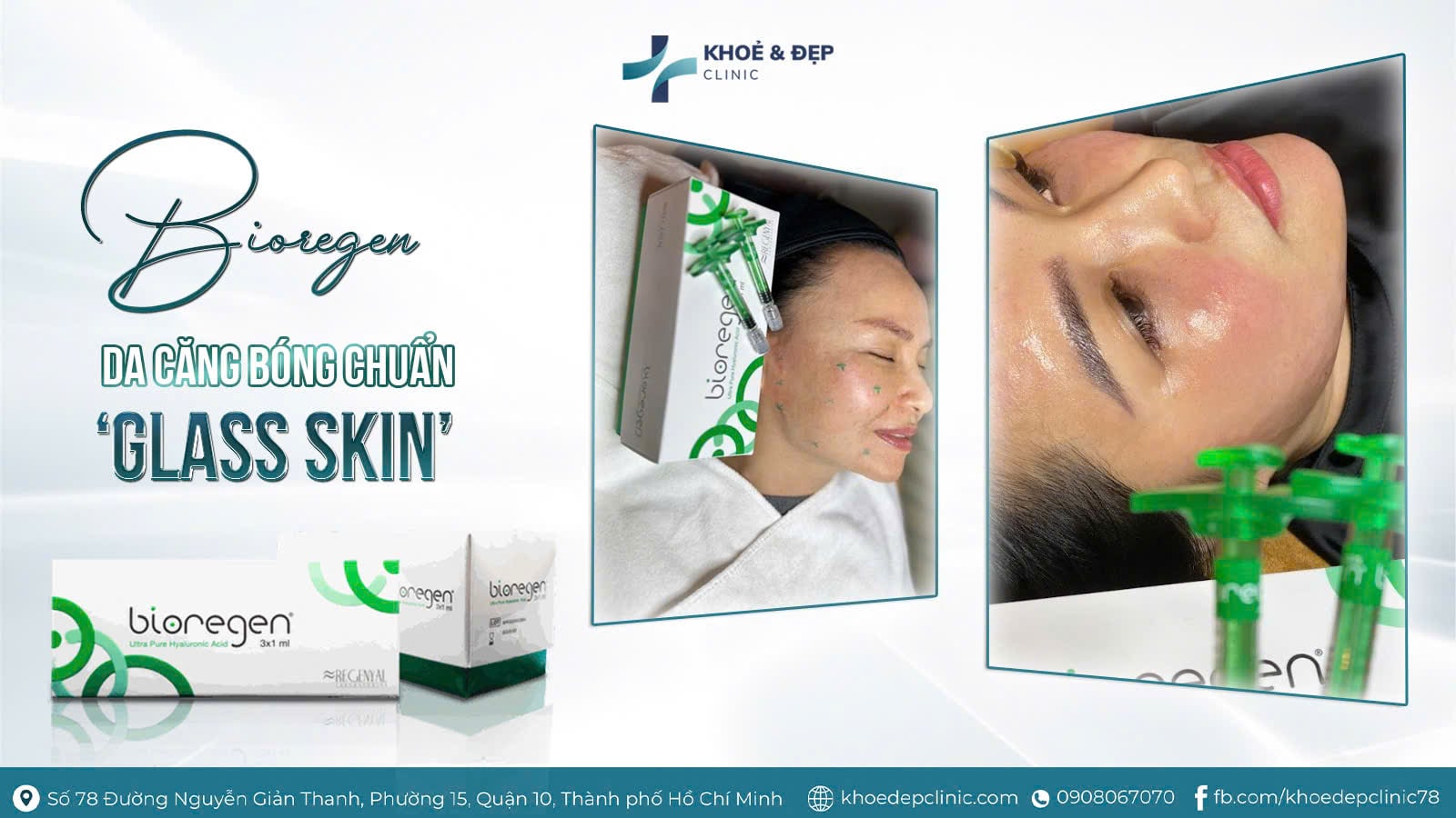 CẤY COLLAGEN - DA CĂNG MỌNG NHƯ SƯƠNG SỚM