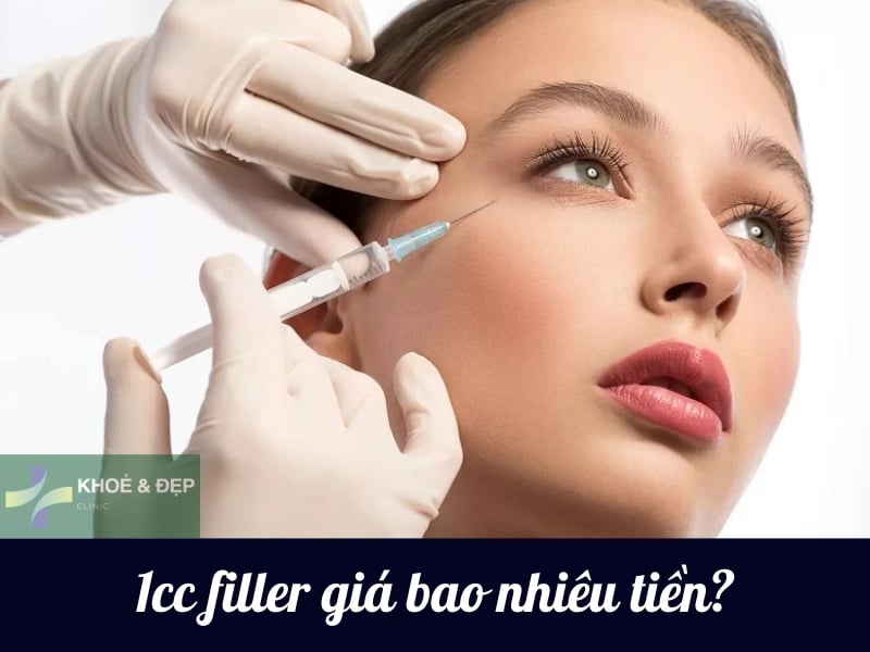 1cc filler có giá bao nhiêu tiền?