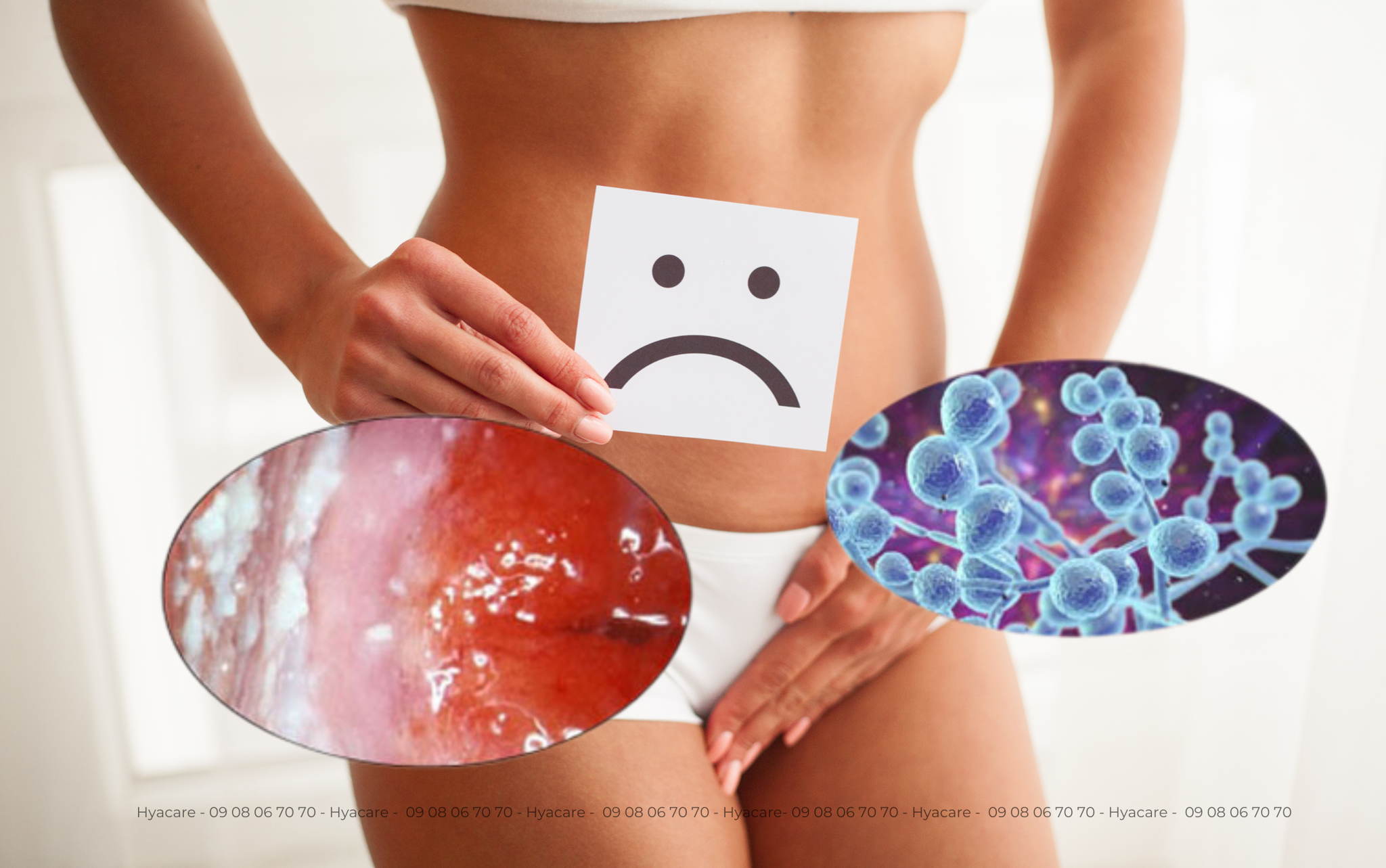 Nguy cơ viêm nhiễm & nhiễm nấm