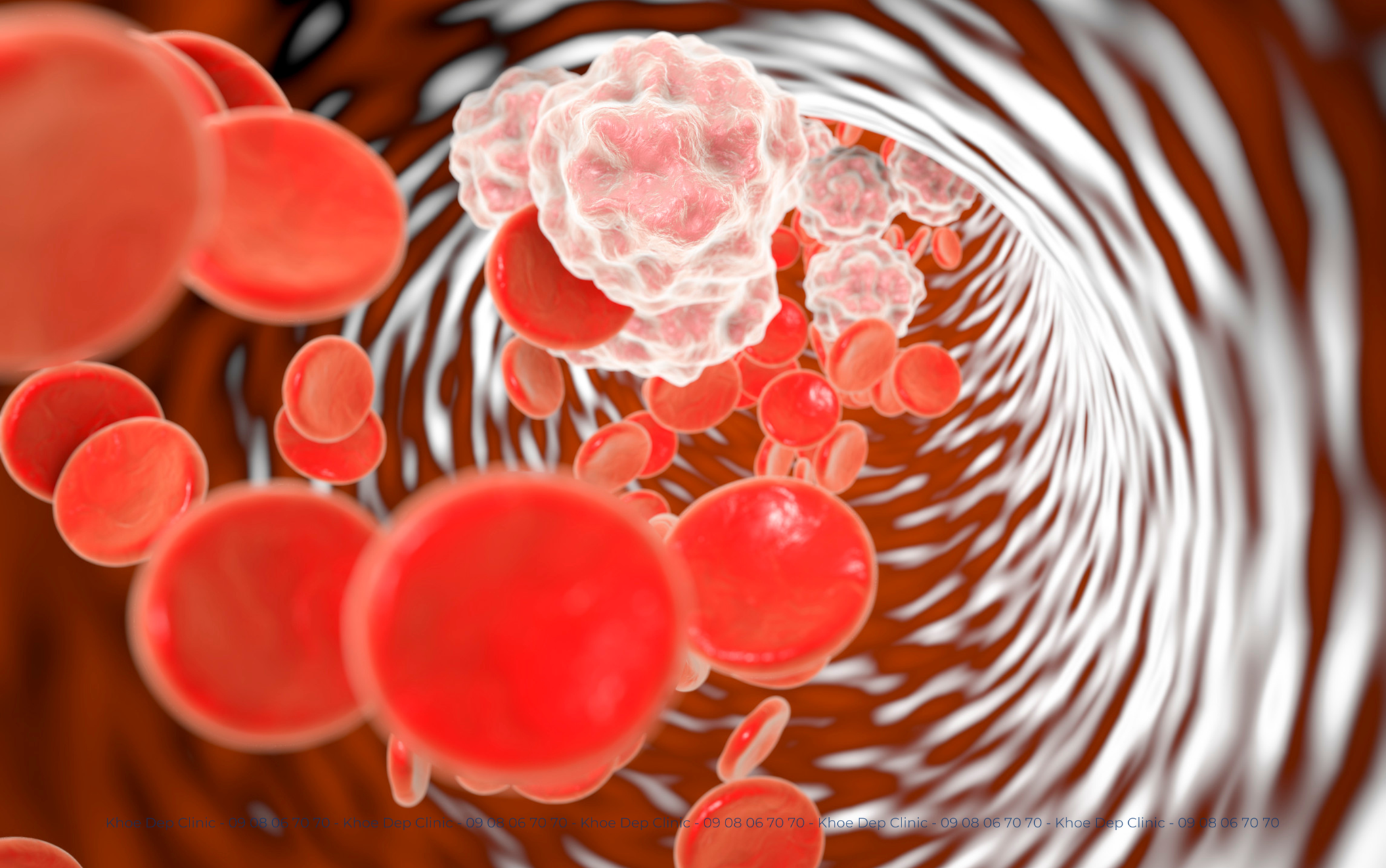 Giảm Lưu Thông Máu