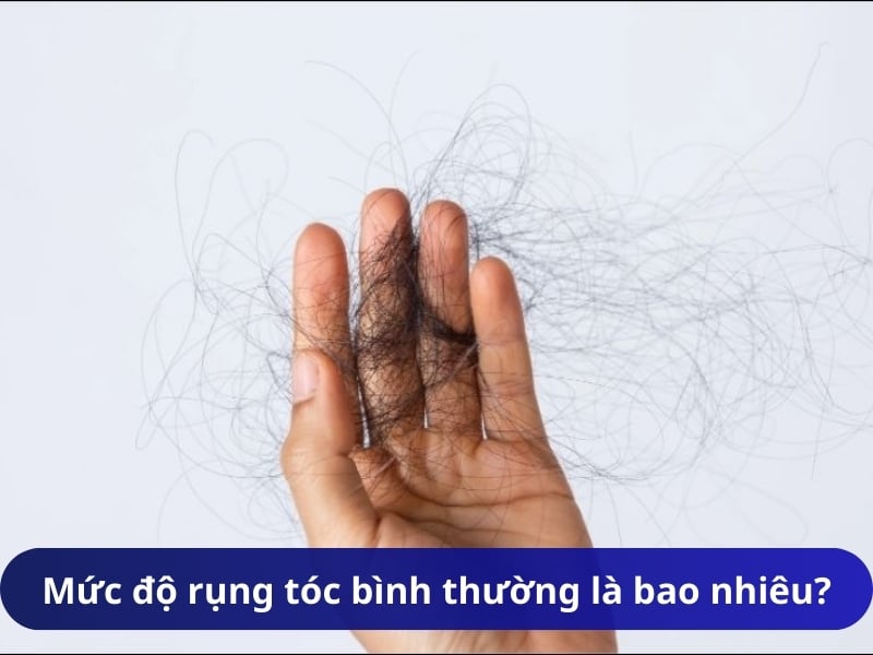 Mức độ rụng tóc bình thường là bao nhiêu?